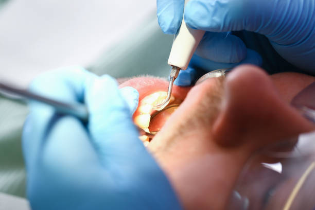 Best Urgent Dental Care for Toothaches in Purcellville, VA