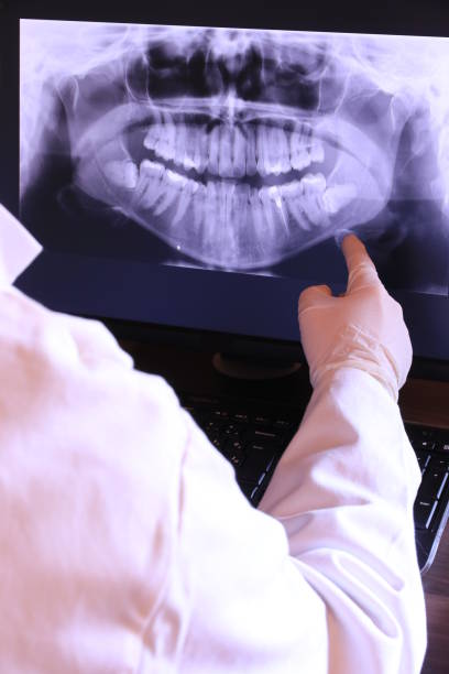 Best Dental Abscess Treatment in Purcellville, VA