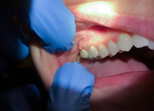 Best Emergency Root Canal Therapy in Purcellville, VA