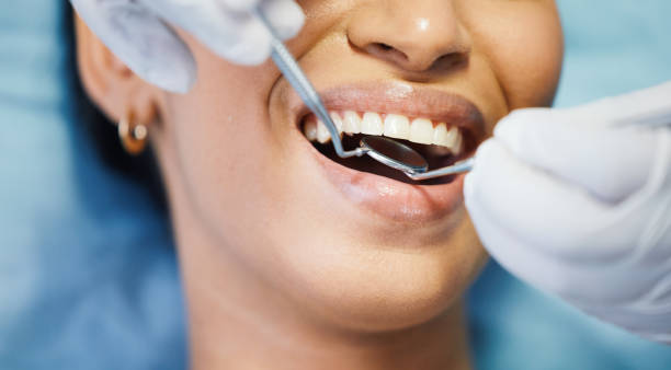 Best Weekend Emergency Dental Services in Purcellville, VA